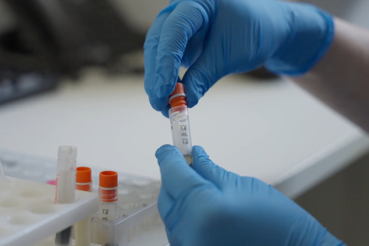 prikaz laboranta koji radi laboratorijske analize
